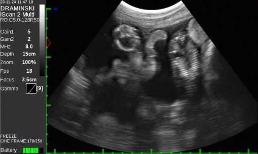 Draminski iScan 2 MULTI Ultrasound Scanner - Image 12