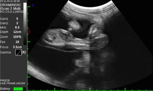 Draminski iScan 2 MULTI Ultrasound Scanner - Image 9