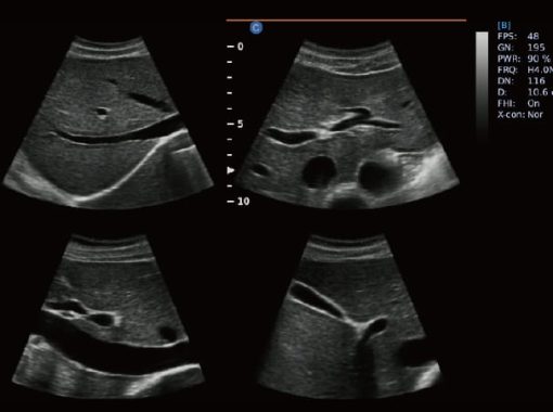 - Abdomen，4B Mode Ebit50 Medical