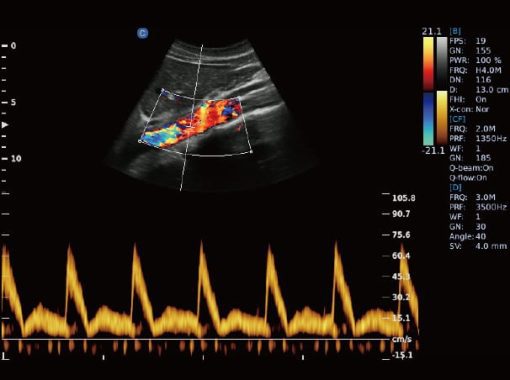 Chison EBit50 Medical Ultrasound - Image 23