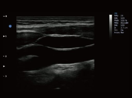 Chison EBit50 Medical Ultrasound - Image 12