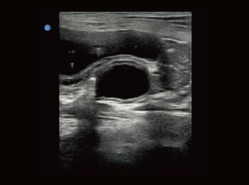 Chison EBit30 Vet Ultrasound - Image 15