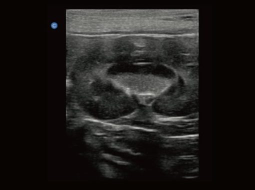 Chison EBit30 Vet Ultrasound - Image 20
