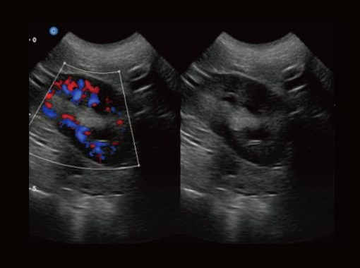 - Canine Kidney B.BC Mode EBit50