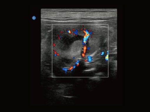 - Canine Kidney C Mode Ebit50