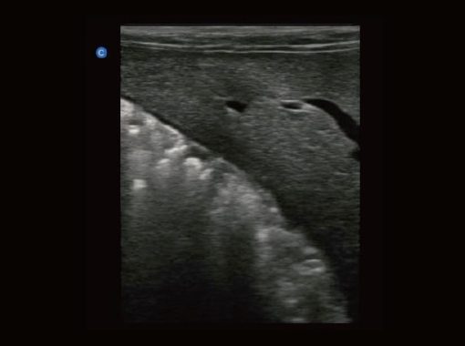 Chison EBit30 Vet Ultrasound - Image 14
