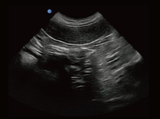 Chison EBit30 Vet Ultrasound - Image 12