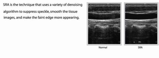 Chison EBit30 Vet Ultrasound - Image 27