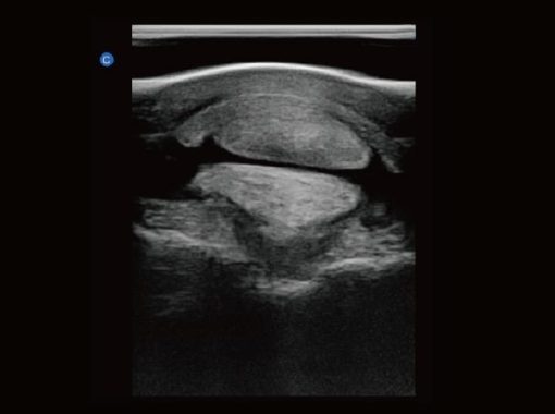Chison EBit30 Vet Ultrasound - Image 17