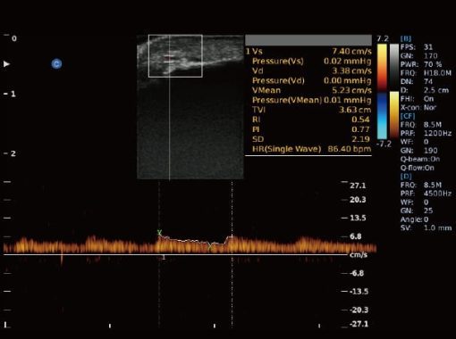 Chison EBit50 Medical Ultrasound - Image 15