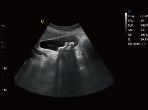 Chison EBit50 Medical Ultrasound - Image 16