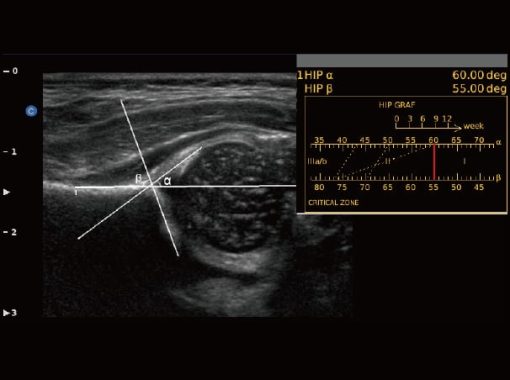 Chison EBit50 Medical Ultrasound - Image 17