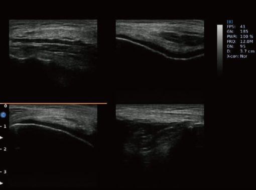 - Knee 4B Mode Ebit50 Medical