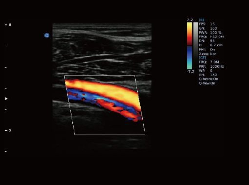 Chison EBit50 Medical Ultrasound - Image 20