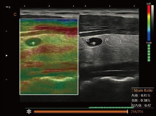 Chison SonoBook 8 VET - Image 9