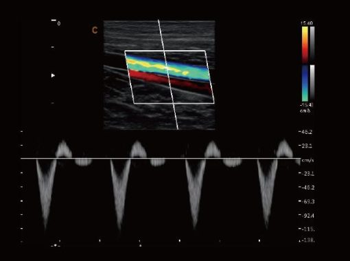 Chison SonoBook 9 VET - sonobook 9.3