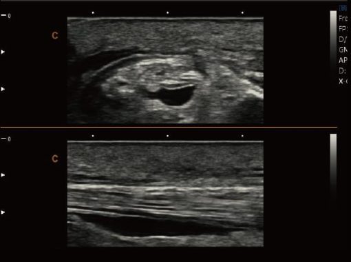 Chison SonoBook 8 VET - Image 11