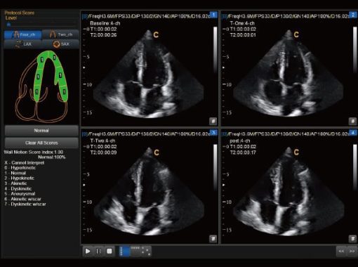 Chison SonoBook 9 VET - sonobook 9.5