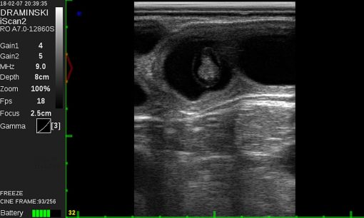 Draminski iScan 2 Ultrasound Scanner - Image 14
