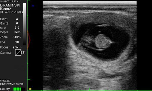Draminski iScan 2 Ultrasound Scanner - Image 15