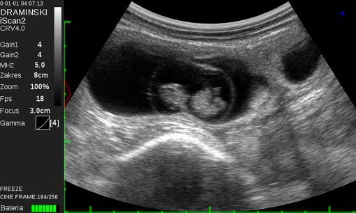Draminski iScan 2 Ultrasound Scanner - Image 16