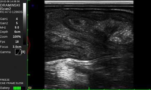Draminski iScan 2 Ultrasound Scanner - Image 17
