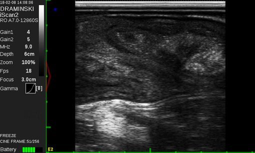 - Krowa endometritis iScan2