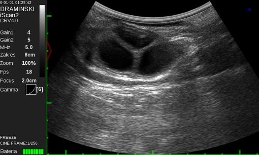 Draminski iScan 2 Ultrasound Scanner - Image 19