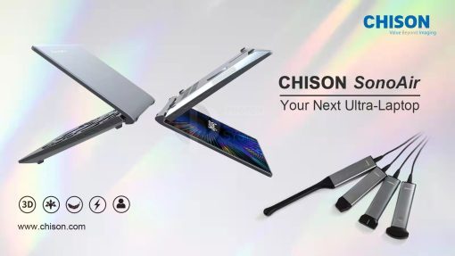 Chison SonoAir - Image 8