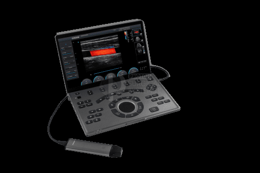 Chison SonoAir - Image 3