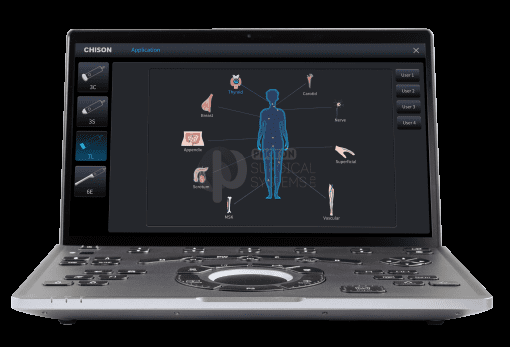 Chison SonoAir - Image 4