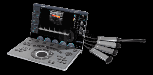Chison SonoAir - Image 5
