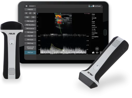 ASUS VET Wireless Ultrasound Probes - Image 2