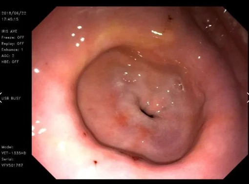 Endoscopy Processor System VET-OR1200HD - Image 6